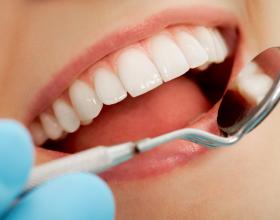 Καθαρισμός Δοντιών,οδοντίατροι ,λαρισα